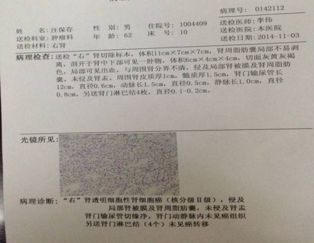 我读你看系列——肾细胞癌篇 我读你看系列——肾细胞癌篇