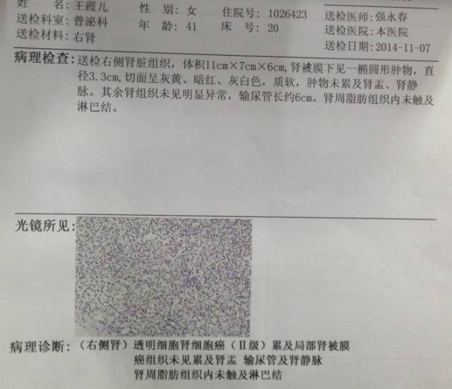 我读你看系列——肾细胞癌篇 我读你看系列——肾细胞癌篇