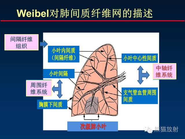 【PPT】肺内间质改变的基本CT征象