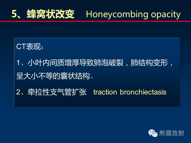 【PPT】肺内间质改变的基本CT征象