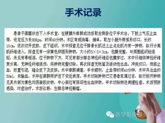 【病例】小腿神经鞘瘤1例CT及MR影像表现