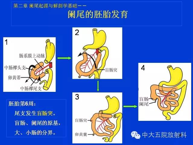 【PPT】正常阑尾和阑尾炎的CT表现