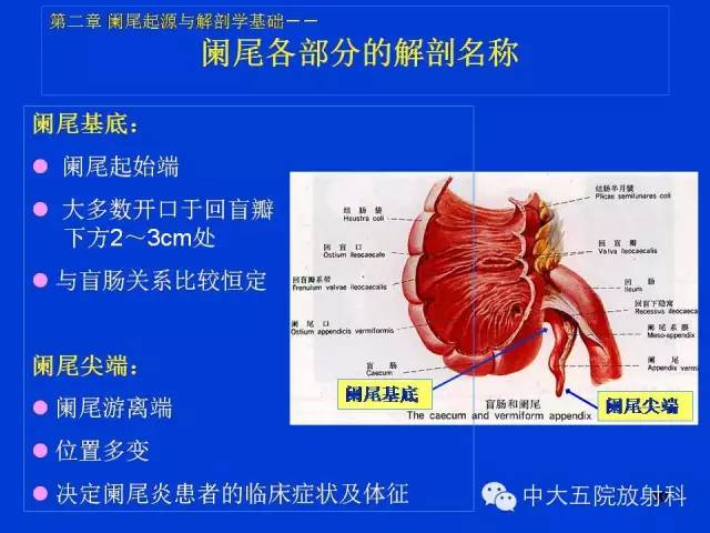 【PPT】正常阑尾和阑尾炎的CT表现