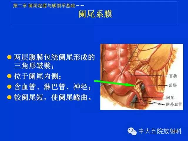 【PPT】正常阑尾和阑尾炎的CT表现