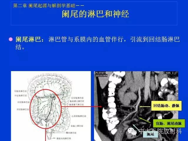 【PPT】正常阑尾和阑尾炎的CT表现