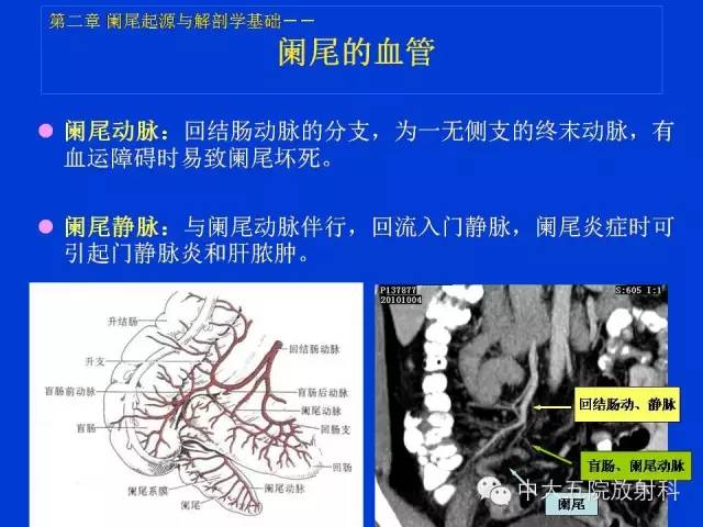【PPT】正常阑尾和阑尾炎的CT表现