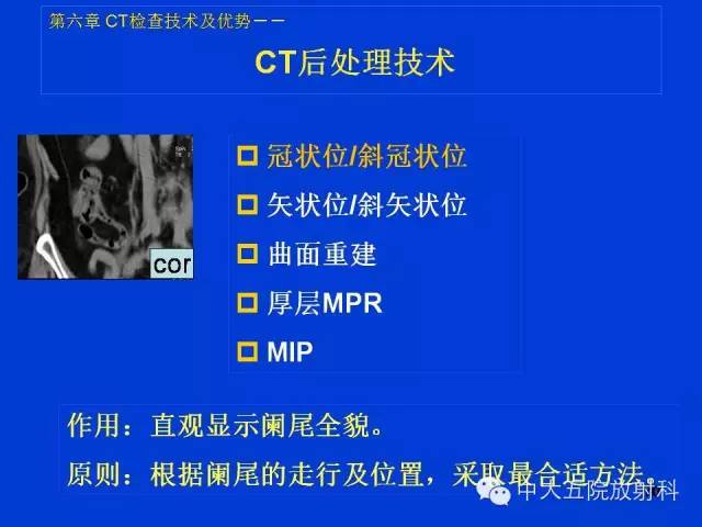 【PPT】正常阑尾和阑尾炎的CT表现