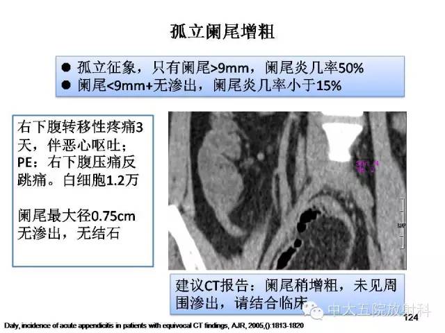 【PPT】正常阑尾和阑尾炎的CT表现