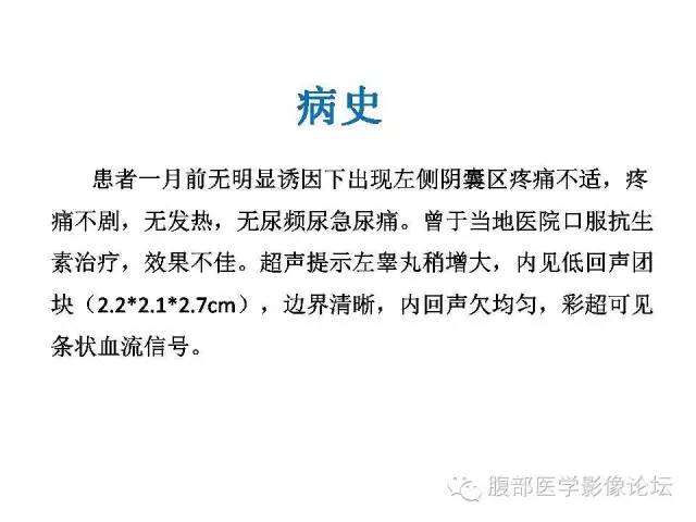 【病例】左侧睾丸及精索结核1例CT及MR