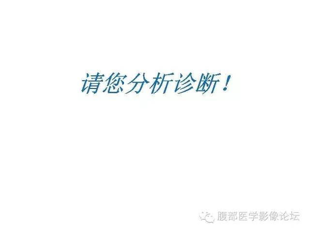 【病例】左侧睾丸及精索结核1例CT及MR 【病例】左侧睾丸及精索结核1例CT及MR