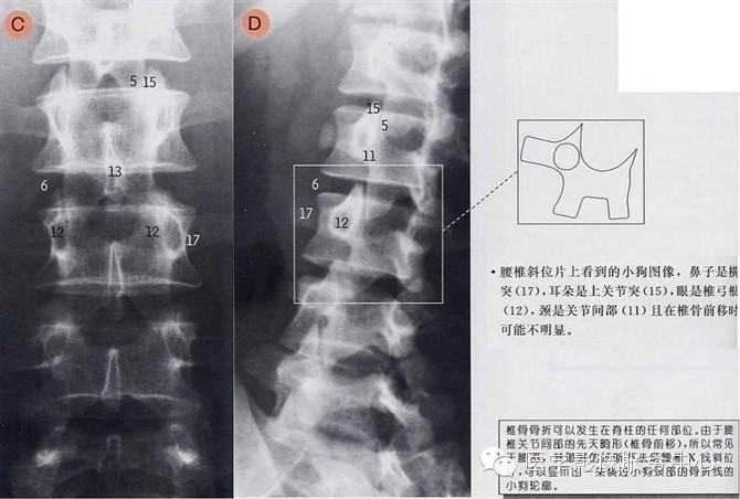 诊断腰椎峡部不连应拍何种位置的X线片？