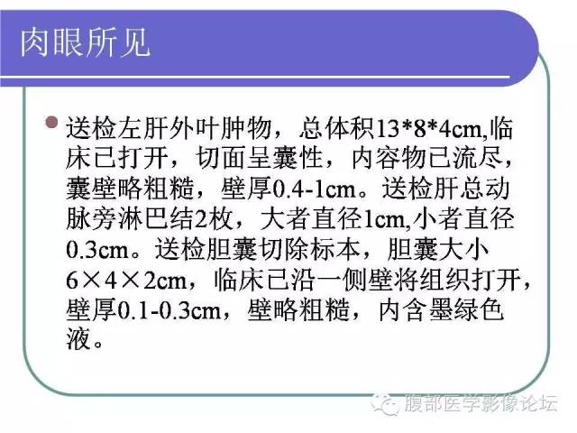 【病例】肝内胆管囊腺瘤1例CT影像表现 【病例】肝内胆管囊腺瘤1例CT影像表现