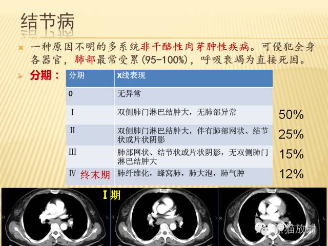 【PPT】间质性肺疾病的鉴别诊断