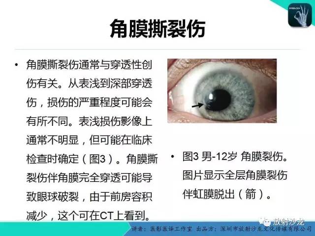 【PPT】眼球外伤-放射科医生能提供什么？