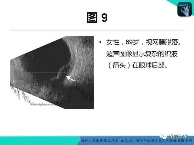 【PPT】眼球外伤-放射科医生能提供什么？