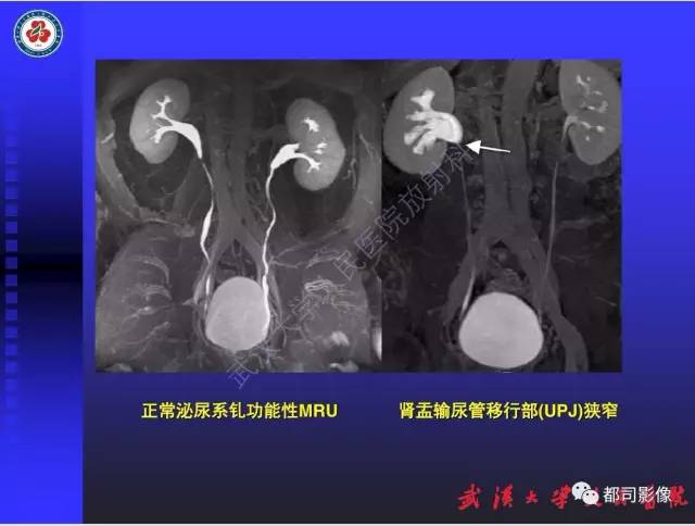 【PPT】泌尿系病变CT&MRI新技术及临床应用