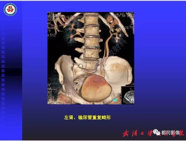 【PPT】泌尿系病变CT&MRI新技术及临床应用