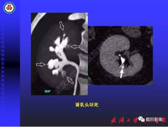 【PPT】泌尿系病变CT&MRI新技术及临床应用