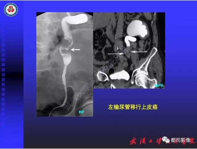【PPT】泌尿系病变CT&MRI新技术及临床应用