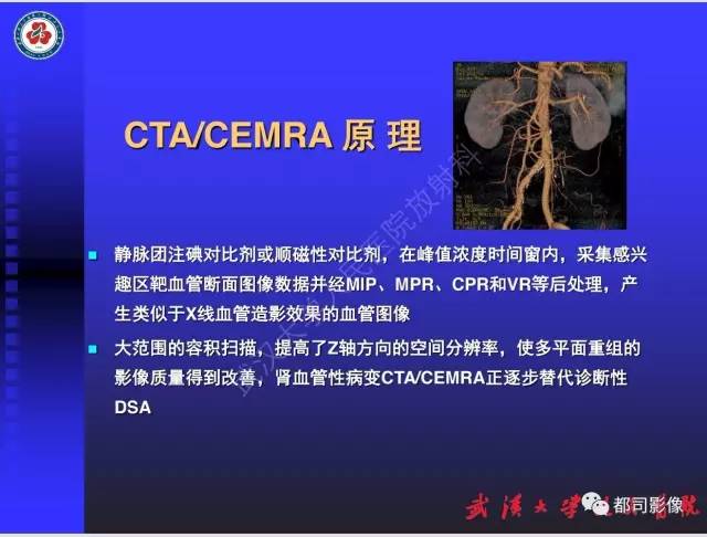 【PPT】泌尿系病变CT&MRI新技术及临床应用