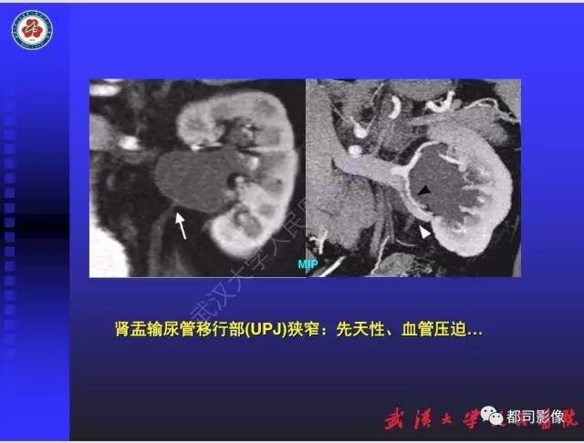 【PPT】泌尿系病变CT&MRI新技术及临床应用