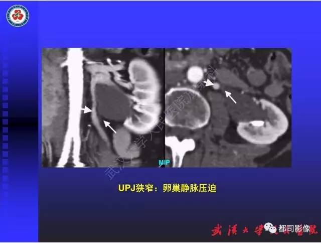 【PPT】泌尿系病变CT&MRI新技术及临床应用