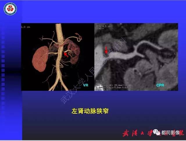 【PPT】泌尿系病变CT&MRI新技术及临床应用