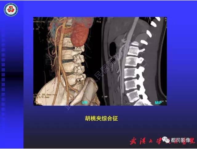 【PPT】泌尿系病变CT&MRI新技术及临床应用