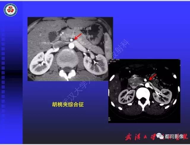 【PPT】泌尿系病变CT&MRI新技术及临床应用