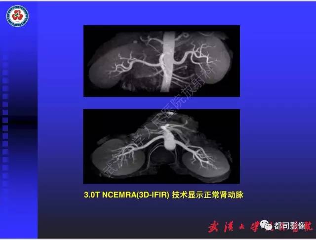 【PPT】泌尿系病变CT&MRI新技术及临床应用