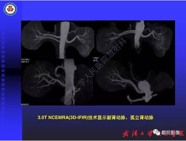 【PPT】泌尿系病变CT&MRI新技术及临床应用
