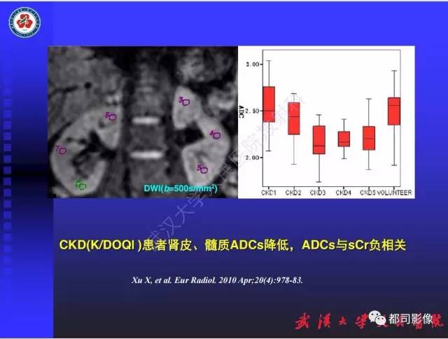 【PPT】泌尿系病变CT&MRI新技术及临床应用