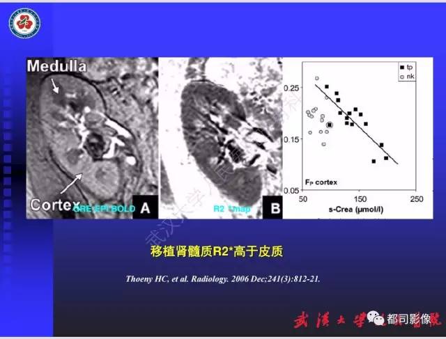 【PPT】泌尿系病变CT&MRI新技术及临床应用
