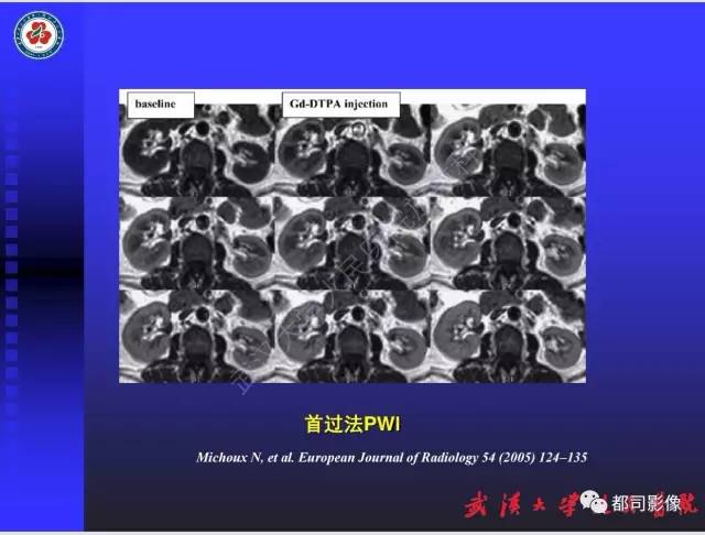 【PPT】泌尿系病变CT&MRI新技术及临床应用