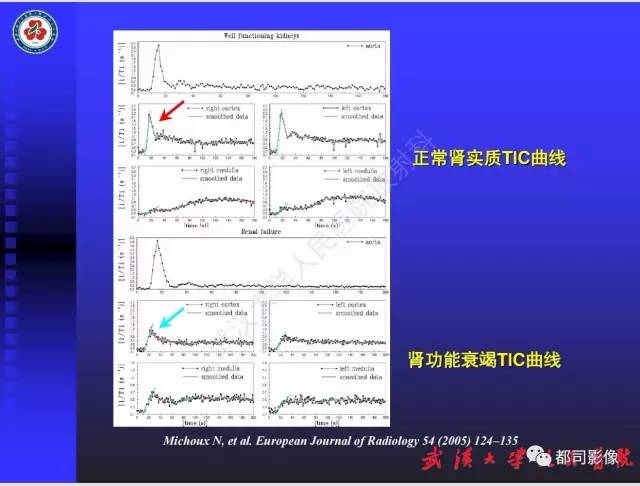 【PPT】泌尿系病变CT&MRI新技术及临床应用