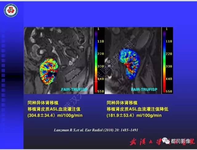 【PPT】泌尿系病变CT&MRI新技术及临床应用