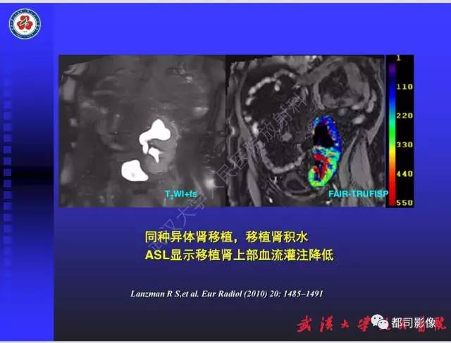 【PPT】泌尿系病变CT&MRI新技术及临床应用