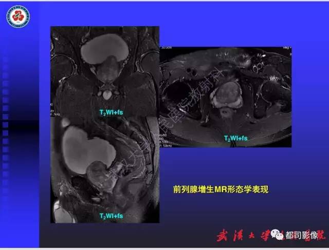 【PPT】泌尿系病变CT&MRI新技术及临床应用