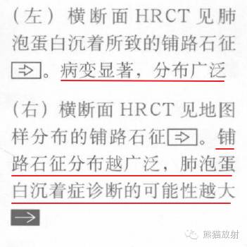 【书摘】“铺路石征”的鉴别诊断