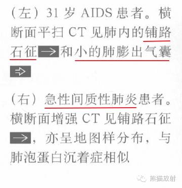 【书摘】“铺路石征”的鉴别诊断