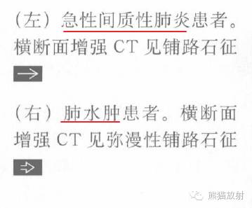 【书摘】“铺路石征”的鉴别诊断