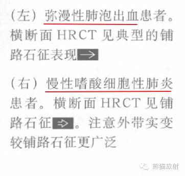 【书摘】“铺路石征”的鉴别诊断
