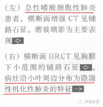 【书摘】“铺路石征”的鉴别诊断