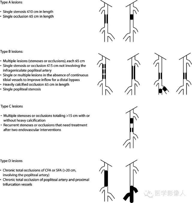 下肢CTA解剖及疾病谱