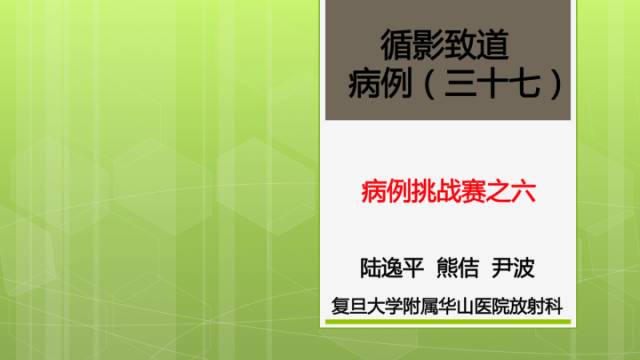 【病例】右侧海绵窦旁不典型神经鞘瘤1例CT及MR影像表现