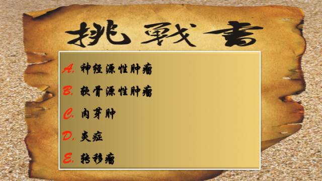 【病例】右侧海绵窦旁不典型神经鞘瘤1例CT及MR影像表现
