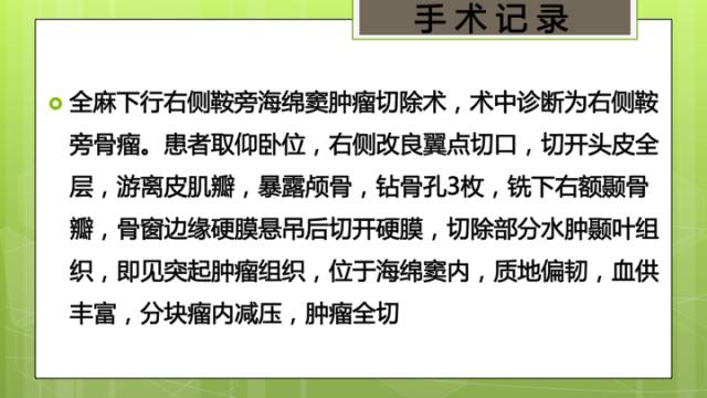 【病例】右侧海绵窦旁不典型神经鞘瘤1例CT及MR影像表现