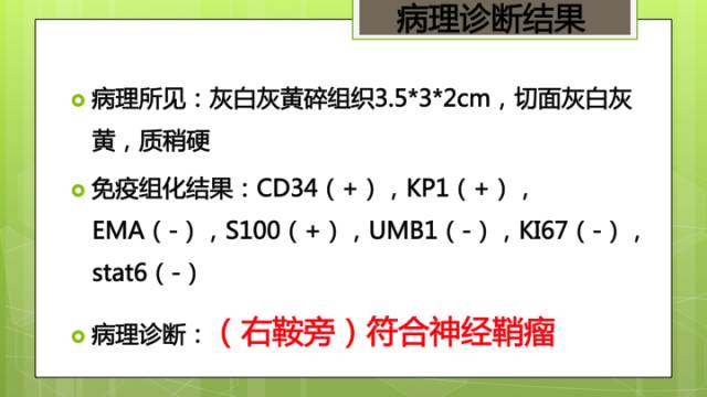 【病例】右侧海绵窦旁不典型神经鞘瘤1例CT及MR影像表现