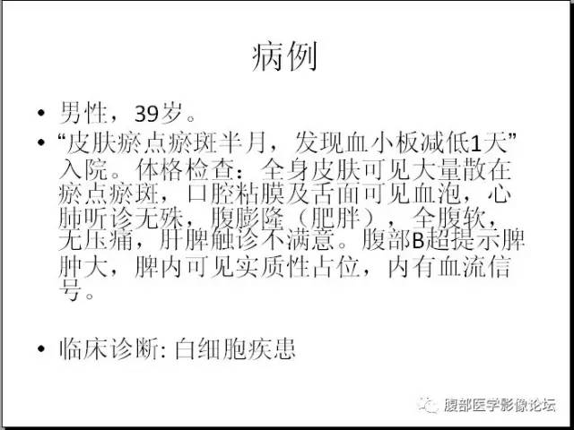 【病例】脾硬化性血管瘤样结节性转化1例CT影像表现
