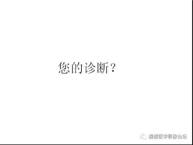 【病例】脾硬化性血管瘤样结节性转化1例CT影像表现 【病例】脾硬化性血管瘤样结节性转化1例CT影像表现